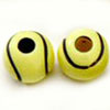 Pony Tennis Ball Beads - Sports Beads - Sports Ball Beads - 